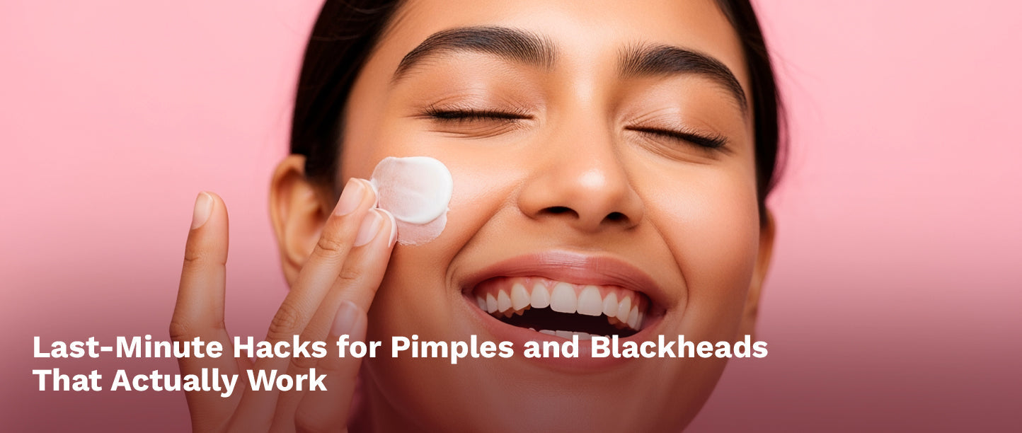 Last-Minute Hacks for Pimples and Blackheads That Actually Work