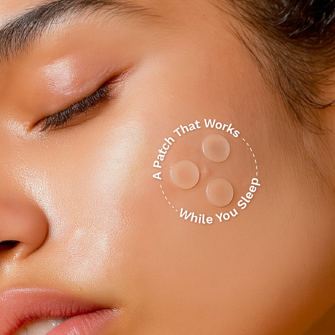 Furr Pimple Patches (30 Patches)