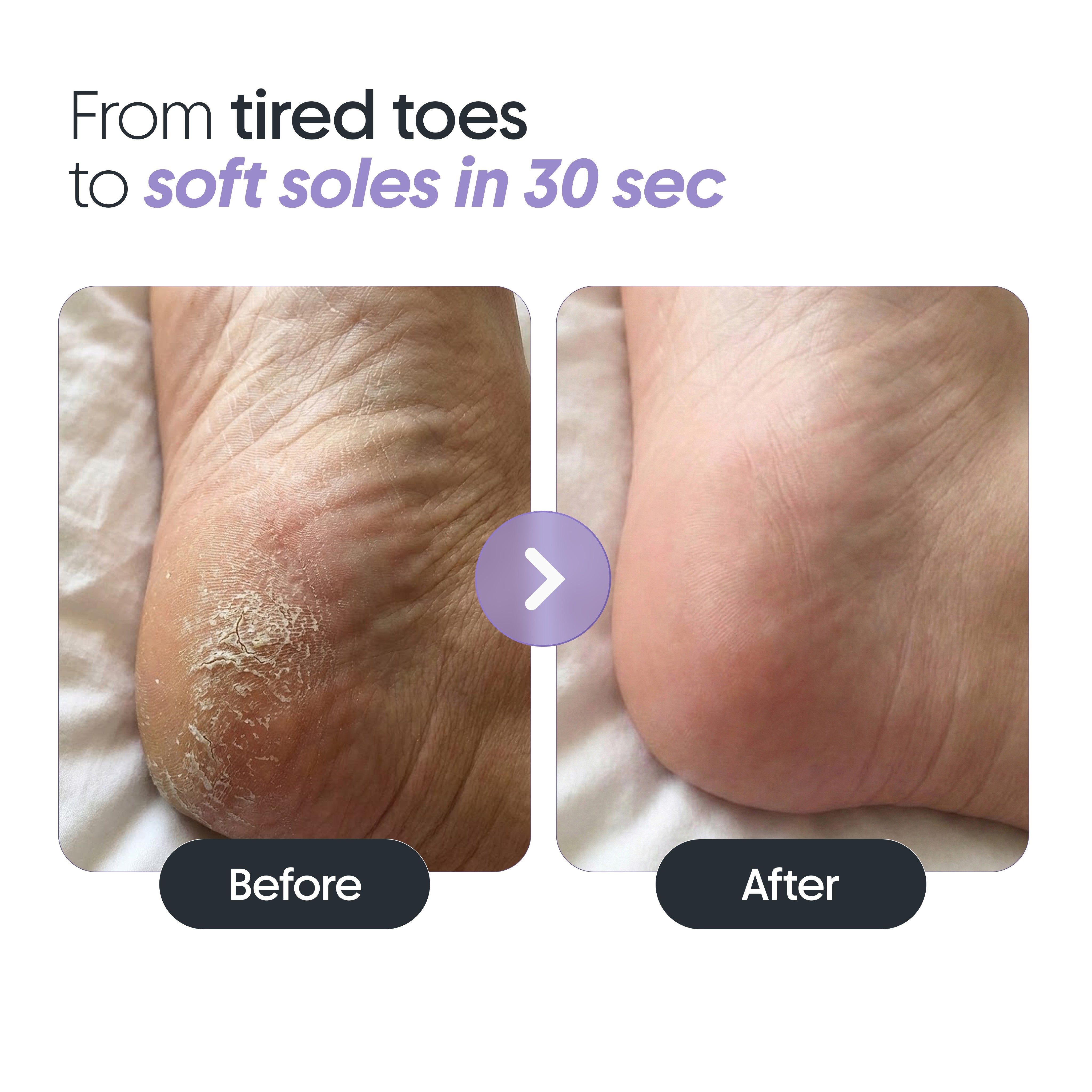 Furr Furr By Pee Safe Instant Pedicure Spray