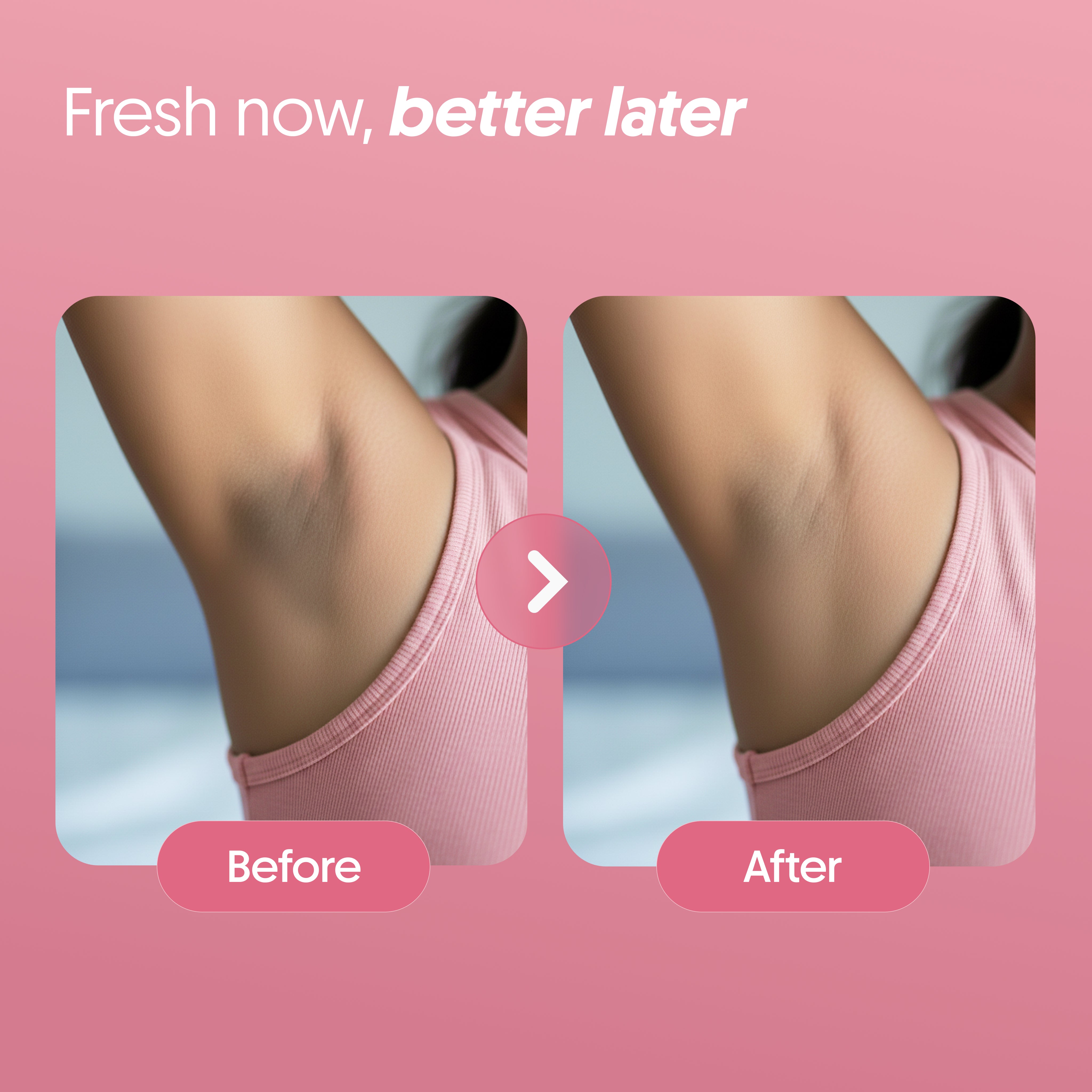 Furr 4% AHA BHA Underarm Roll On - Flora - (BYOC)