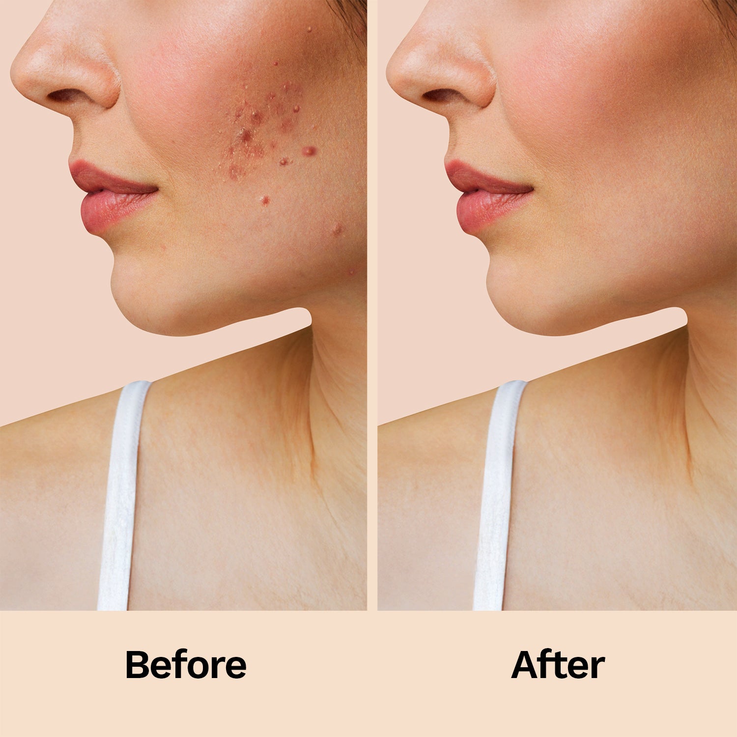 Furr Pimple Patches (60 Patches)