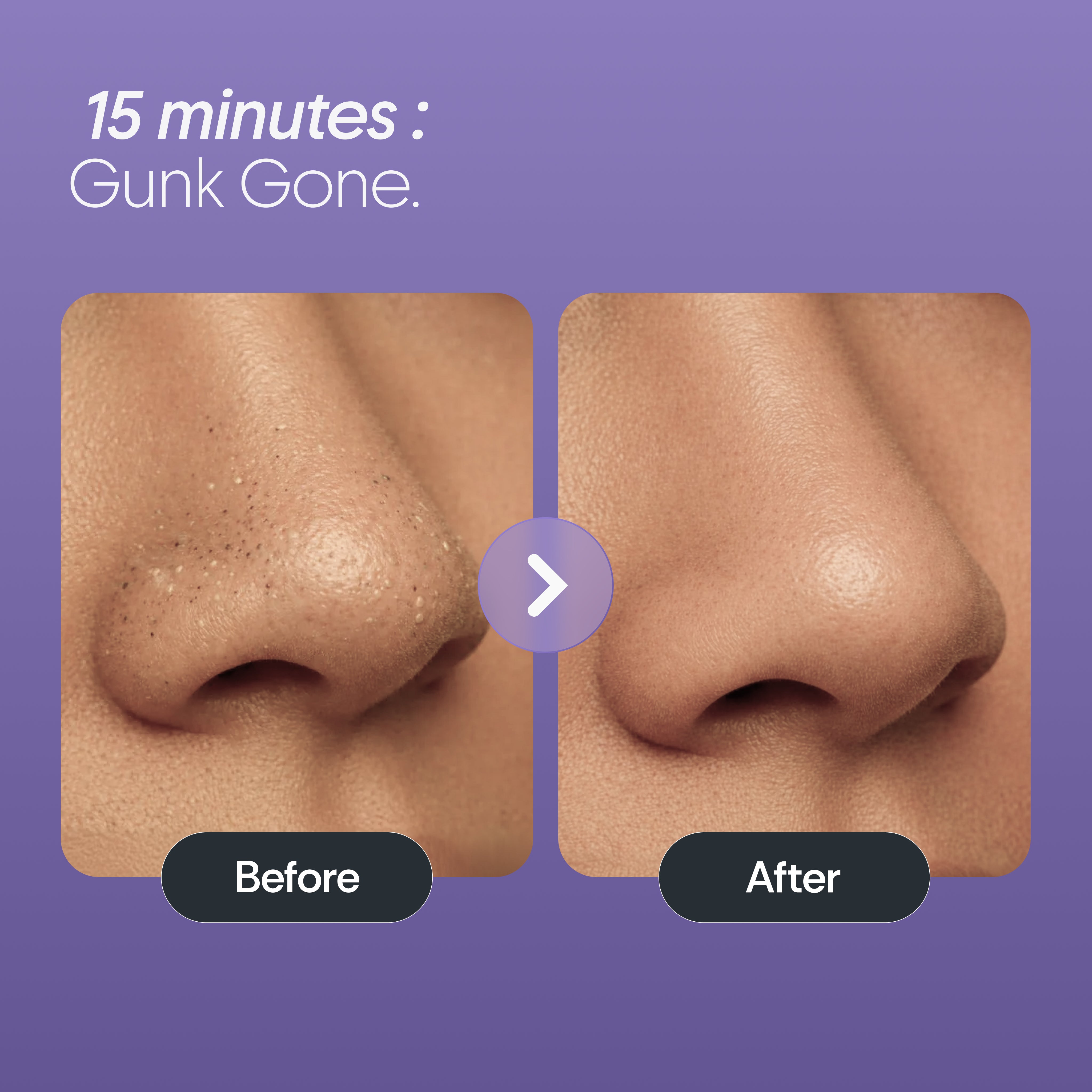 Furr Bamboo Charcoal Nose Strips (3N)