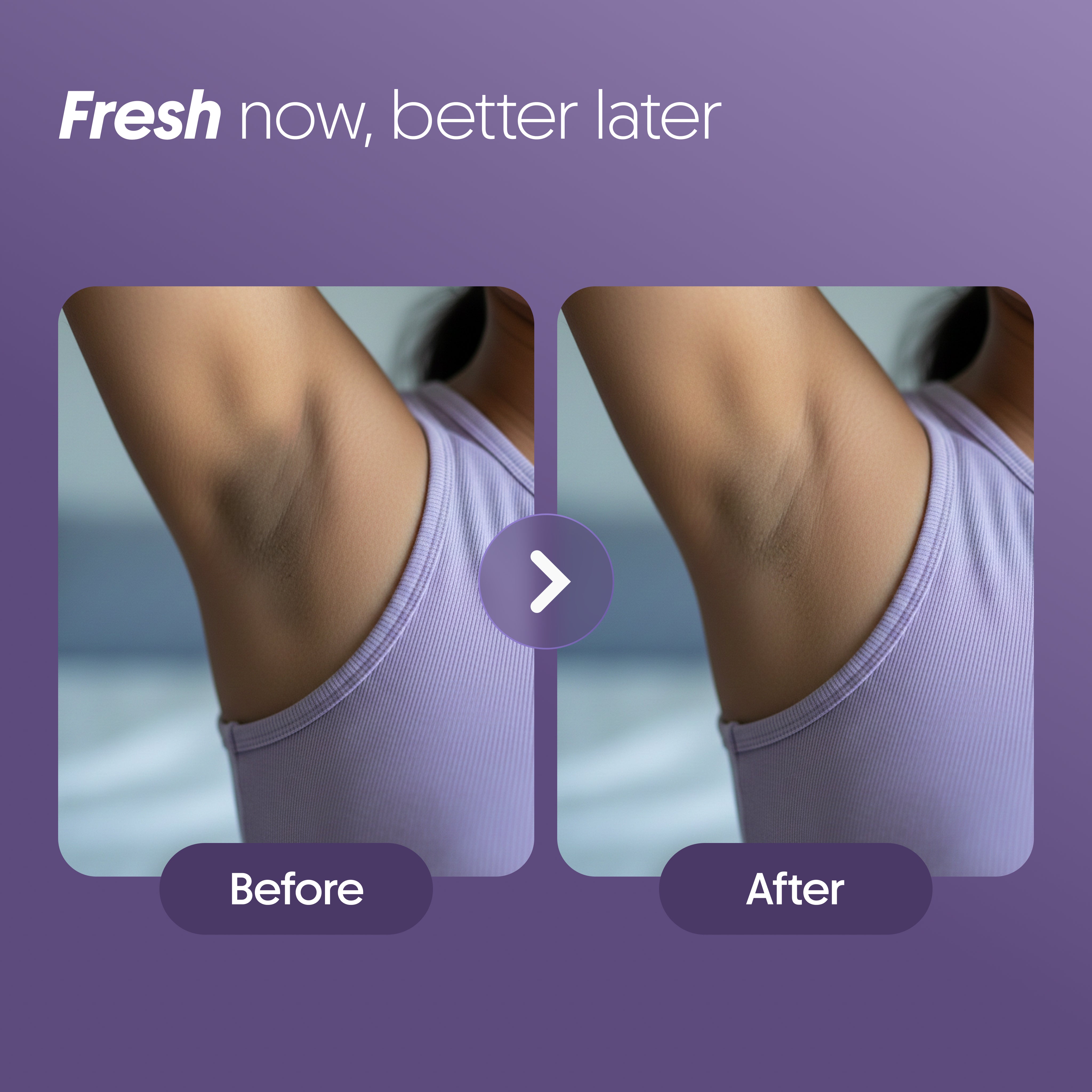 Furr 4% AHA BHA Underarm Roll-On - Aqua - (BYOC)