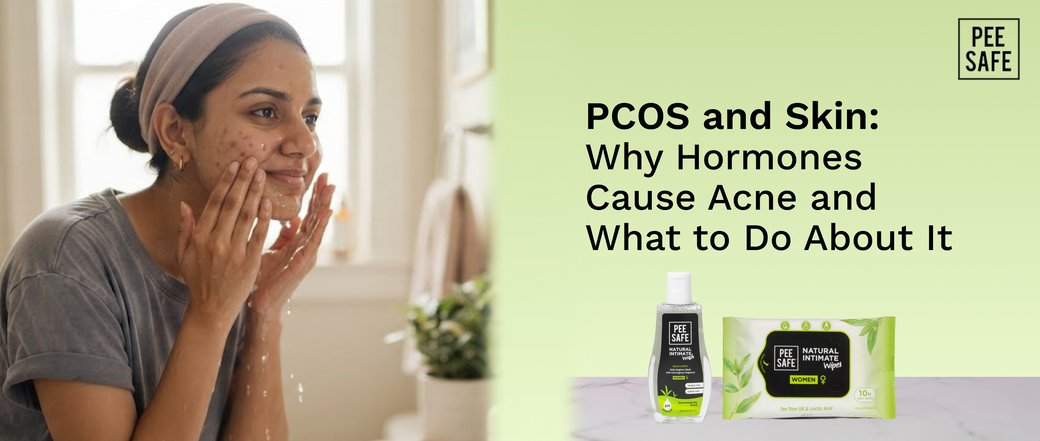 PCOS and Skin: Why Hormones Cause Acne and What to Do About It