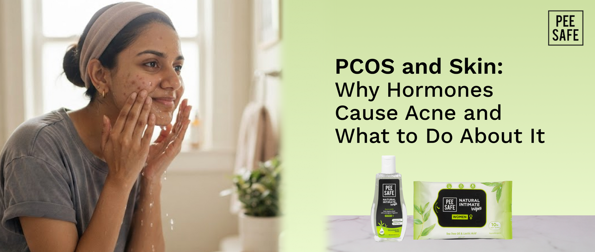 PCOS and Skin: Why Hormones Cause Acne and What to Do About It