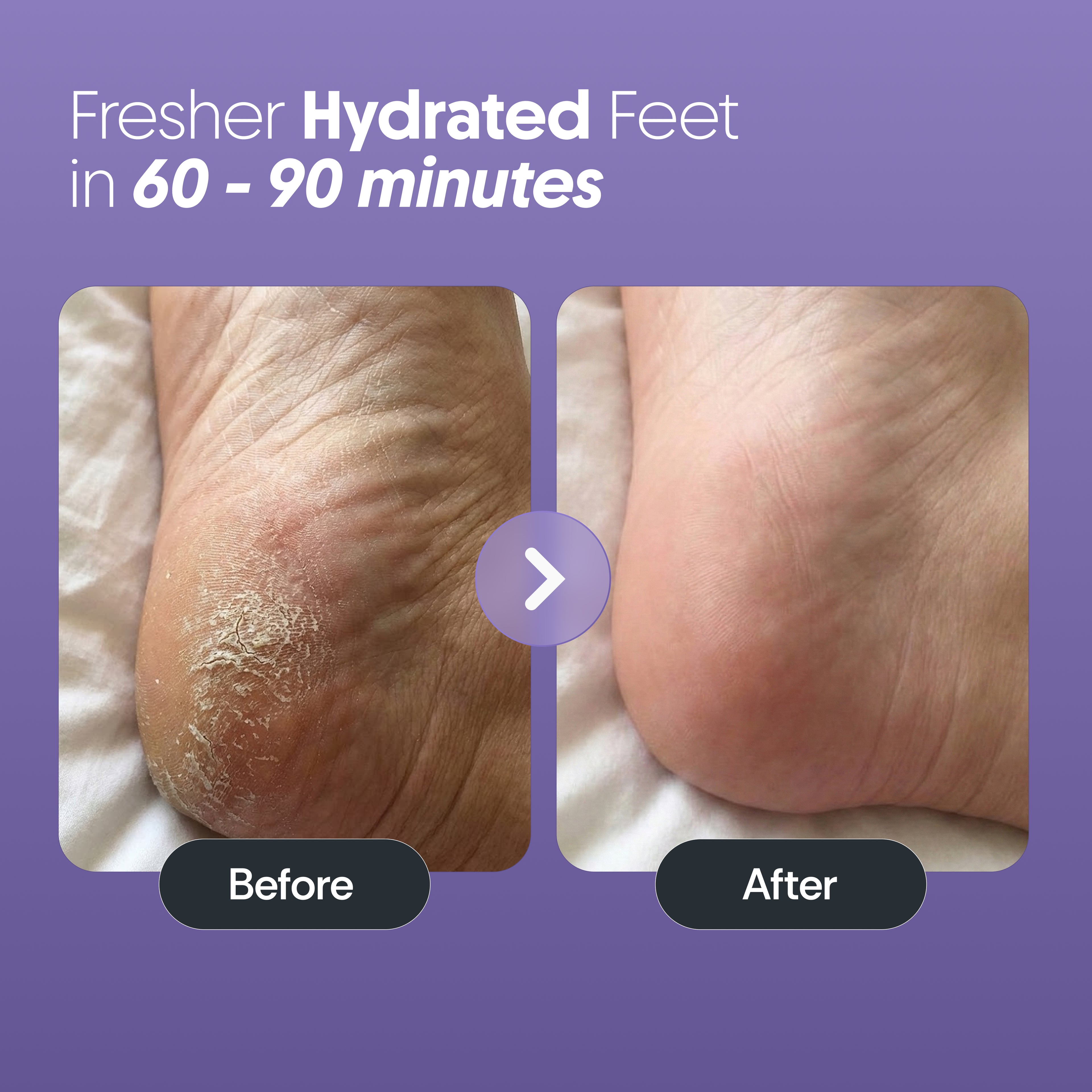 Furr Foot Peel Mask - (BYOC)
