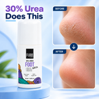 Furr 30% Urea Foot Roll-On