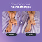 Furr Urea & Natural AHAs Foot Cream - (BYOC)