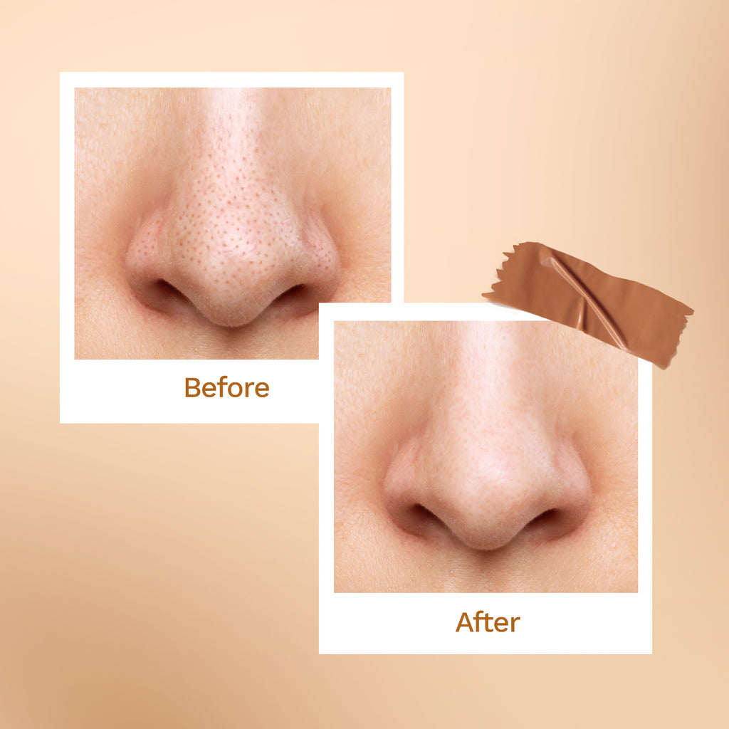 Furr Bamboo Charcoal Nose Strips (3N)