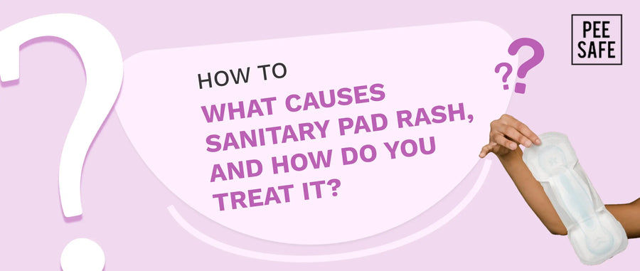 What causes sanitary pad rash, and how do you treat it?